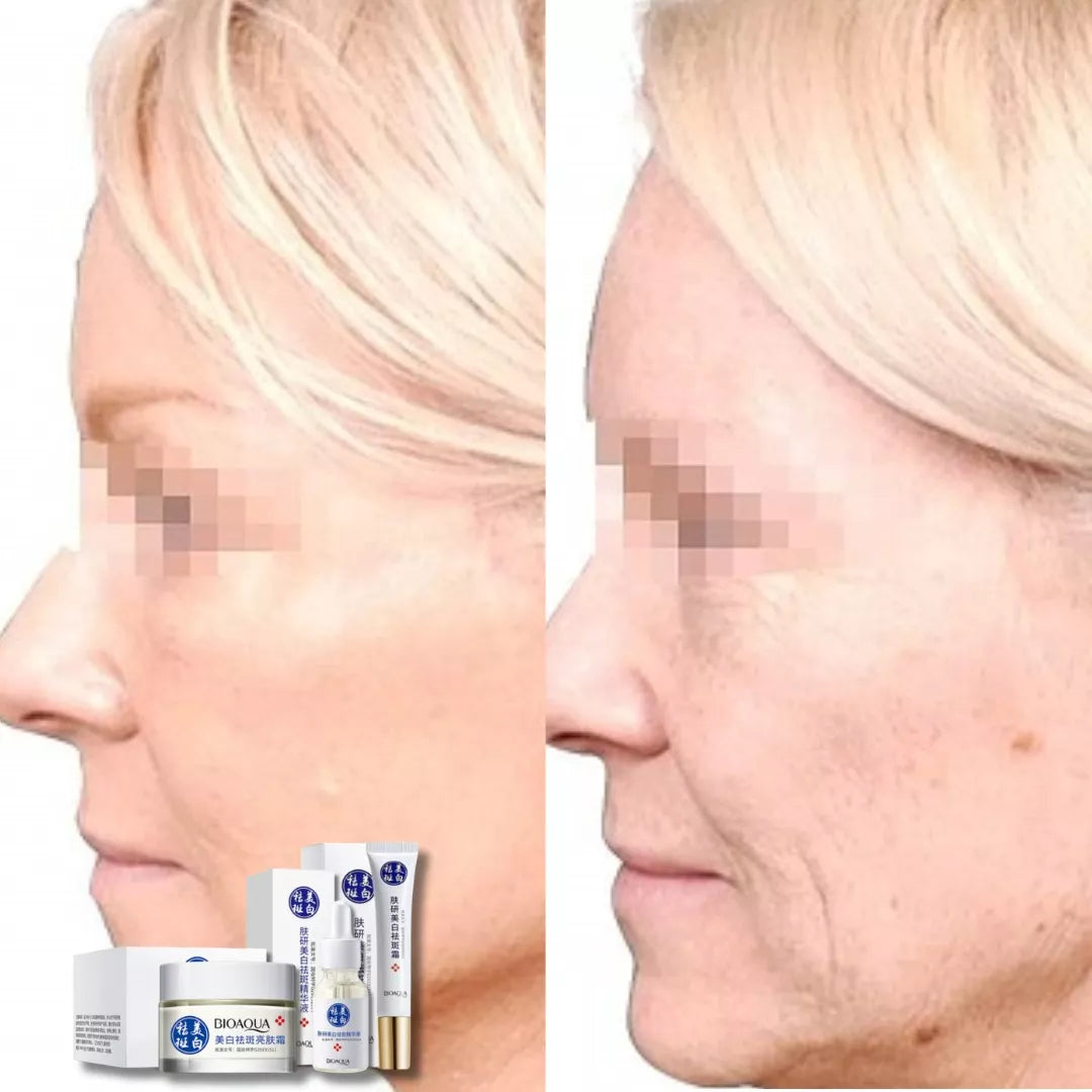 Tratamiento Facial Anti-Manchas y Aclarante BIOAQUA